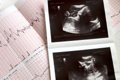 Pro-life gains and losses in Ohio | Baptist Press