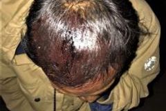 Six Christians Injured in Stoning of Christmas Service in Burma - Morningstar News