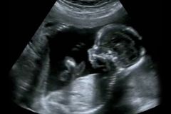 'Short Window of Time': Texas Abortion Ban Forces Pregnancy Centers to Quickly Pivot