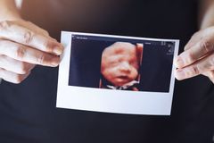 'Fact Checking' the Washington Post: US Abortion Extremism Is on Par with China, N Korea