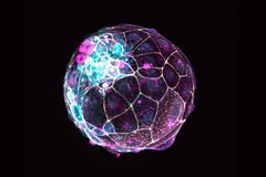 Scientists use stem cells to create models of pre-embryos