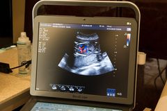Doctors: Advances since Roe confirm abortion ‘takes life of unborn child’