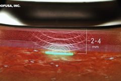 Defense Dept. Develops Next Gen Sensor to Implant Under Human Skin, Like a 'Check Engine Light'