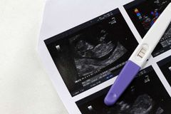 Iowa heartbeat abortion law struck down by state judge