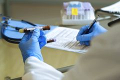 Do You Know Your Uric Acid Level? Here's Why You Should