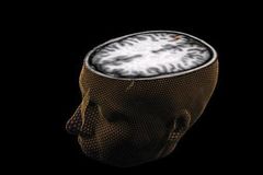 My battle with bipolar disorder: God makes healthy what He doesn't heal