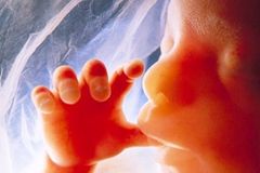 What Idaho and Texas now have in common