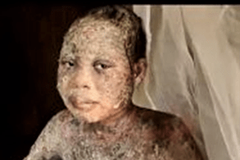 Family Sprayed with Acid for Leaving Islam - Morningstar News