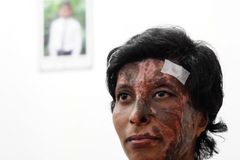 Woman who survived Sri Lanka bombings with terrible burns becomes bride this Easter season