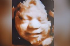 'Win for the Unborn!' Appeals Court Dismisses Final Challenge Against Texas Heartbeat Act