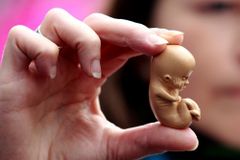 Why abortion is a Gospel issue