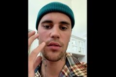Justin Bieber 'trusting God' amid facial paralysis, asks fans for prayers: 'It's all for a reason'