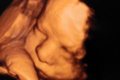 Israeli Pro-Life Group Petitions High Court to Save the Unborn in a Nation Where Abortion is Widely Accepted