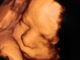 Israeli Pro-Life Group Petitions High Court to Save the Unborn in a Nation Where Abortion is Widely Accepted