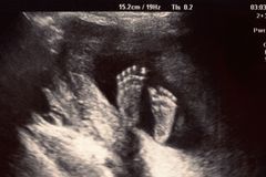 300 Babies Saved After Moms Chose to Reverse Abortions - Here's How
