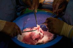 Pig hearts successfully transplanted—twice