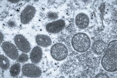 WHO Convenes Emergency Committee as Monkeypox Revealed to Be Primarily a Sexually Transmitted Disease