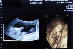 Judge rules life beginning at conception is a ‘distinctly Christian’ idea, blocks Kentucky abortion ban