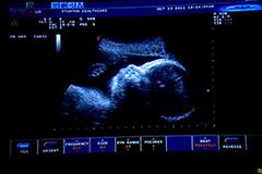 Calls for Clinic's Closure Grow after Abortion Death