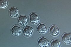 Israeli Biotech Firm Plans to Create Human Embryos to Harvest Organs, Field Experts Say There are Ethical Concerns