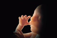 Doctor Who Terminated Hundreds of Pregnancies Totally Transformed After Pastor's Convicting Sermon