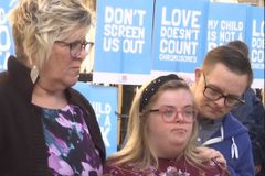 Woman loses appeal to stop killing of babies with Down syndrome, cleft-lip or club foot