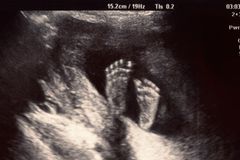 VA Lawmakers Aim to Protect Unborn Babies From Painful Abortions After 15 Weeks