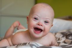 Pro-Life Congresswoman Rebuts 'I Would've Aborted a Fetus with Down Syndrome' Op-Ed
