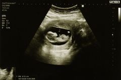 Wyoming advances a new abortion ban to replace blocked ‘trigger law’