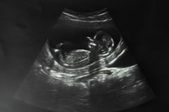 Sorrow over 10,135,618 lives lost since 1967 Abortion Act came into effect