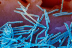 FDA approves first U.S. RSV vaccine