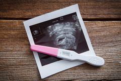 FIRST-PERSON: How your church can serve pregnancy resource centers | Baptist Press