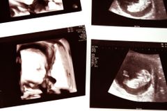 Four recent events related to abortion | Baptist Press
