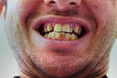 Sorry Gen Z, Science Says You're Ugly - RELEVANT