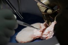 Pig kidney works in man’s body for more than a month