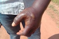 Evangelist, other Christians in Uganda Assaulted - Morningstar News