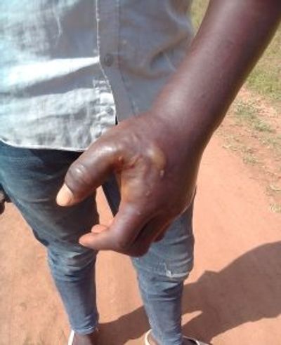 Evangelist, other Christians in Uganda Assaulted - Morningstar News