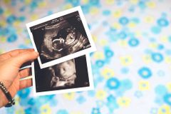 Pregnancy resource centers are not 'fake' clinics