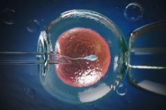 Alabama Republicans introduce bills that would let IVF clinics destroy human embryos