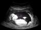 EXPLAINER: How Alabama’s IVF bill undermines the dignity of the unborn | Baptist Press