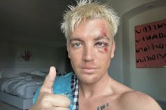 LANY's Paul Klein Was Hospitalized After Being Hit By a Car - RELEVANT