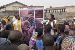 With over 500 dead, UN declares monkeypox emergency