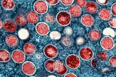 One confirmed case of new mpox variant in Europe