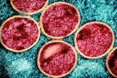 Christians asked to pray for areas affected by mpox