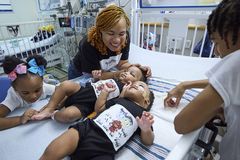 Couple chooses life, take home formerly conjoined twins