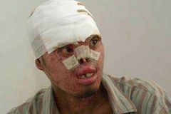 Eyewitness in Ambon, Indonesia: Christians still suffering, dying | Baptist Press