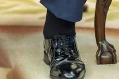 Trump diagnosed with common vein condition