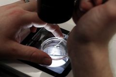 Baby boy born from embryo frozen 30 years ago