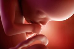 French abortion bill would outlaw 'moral' pressure | Baptist Press