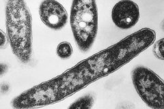 Six die, 111 infected in NYC Legionnaires’ outbreak